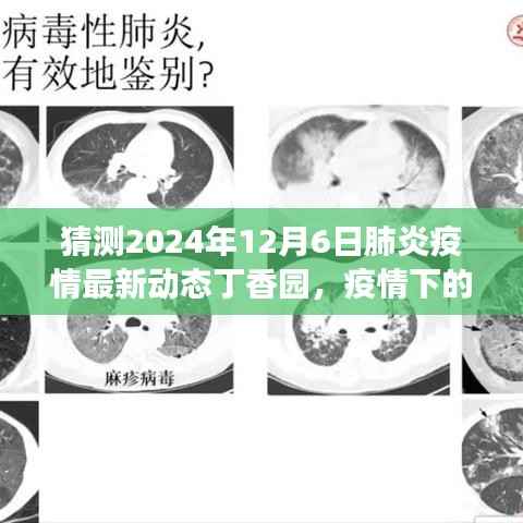 预测未来暖心日常,丁香园展望2024年肺炎疫情最新动态与温馨故事